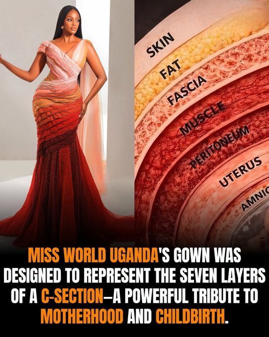 The Scar Is Not the Whole Story: What Miss World Uganda’s Extraordinary Gown Asked Us to See The Scar Is Not the Whole Story: What Miss World Uganda’s Extraordinary Gown Asked Us to See